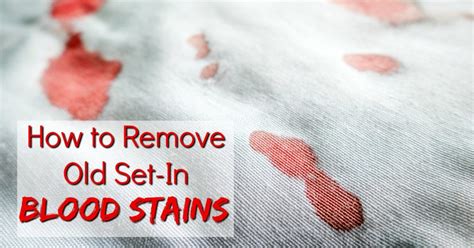 removing dried blood from denim